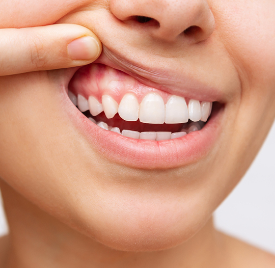 Best Ways to Keep your Gums Healthy